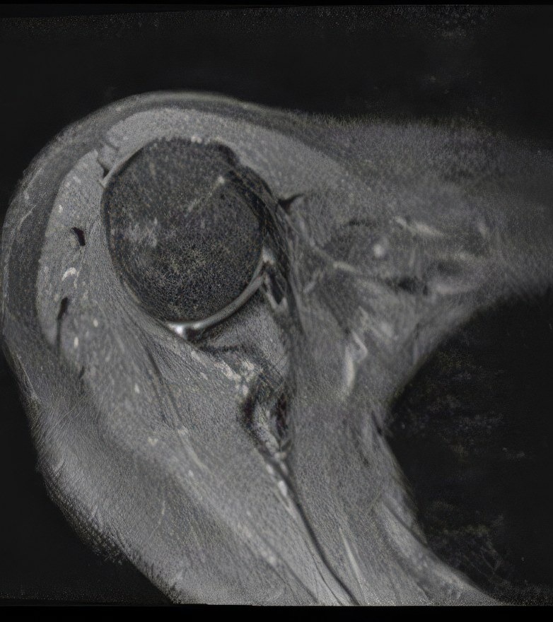 Bark — Ax PD FS — obraz konwencjonalny